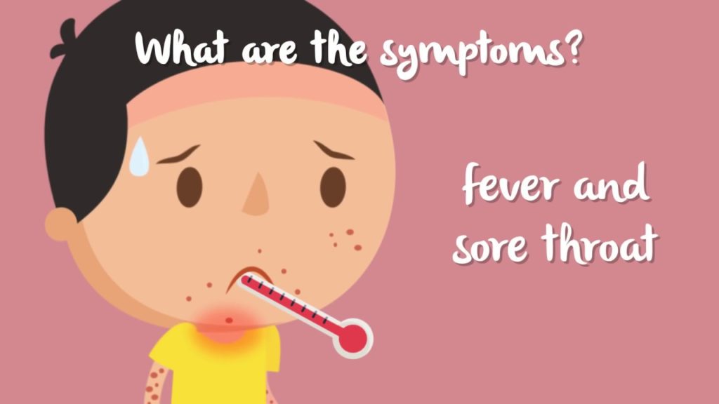 Know All About Hand, Foot and Mouth Disease In Babies